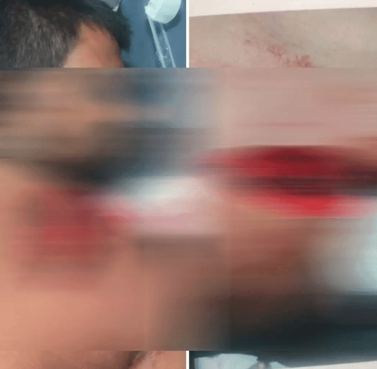 CG : युवकों ने किया होटल संचालक पर चाकू से हमला, लूटपाट के बाद बदमाश फरार