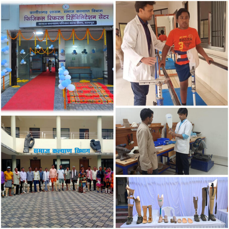 CG : विशेष लेख : फिजिकल रेफरल रिहैबिलिटेशन सेंटर बना मध्यभारत में दिव्यांग पुनर्वास की मिसाल