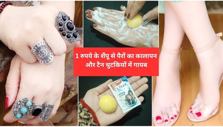 Skin Care Tips: ये 1 रुपये का शैंपू और पैरों का कालापन, टैन चुटकियों में होगा गायब भूल जायेगे महंगे पार्लर, देखे यहाँ देसी उपाय