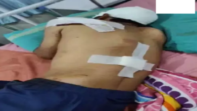 CG : पानी बोर चालू करने को लेकर विवाद, ऑटो ड्राइवर को कुल्हाड़ी से मारा …