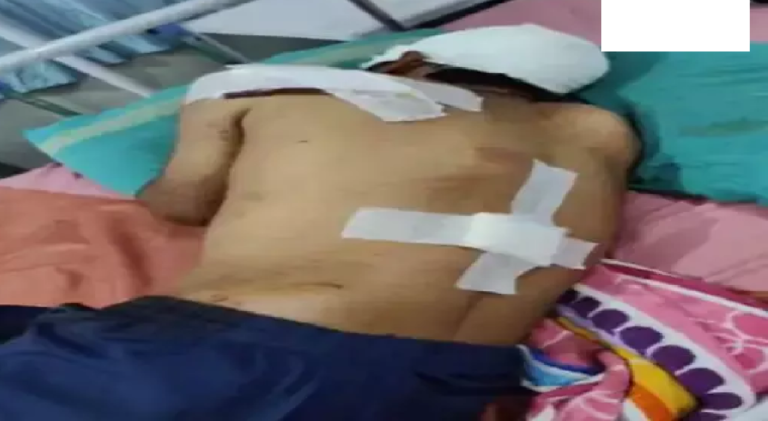 CG : पानी बोर चालू करने को लेकर विवाद, ऑटो ड्राइवर को कुल्हाड़ी से मारा …