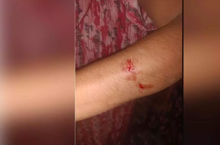 CG : घर में घुसकर महिला के साथ मारपीट, पुलिस जांच में जुटी …