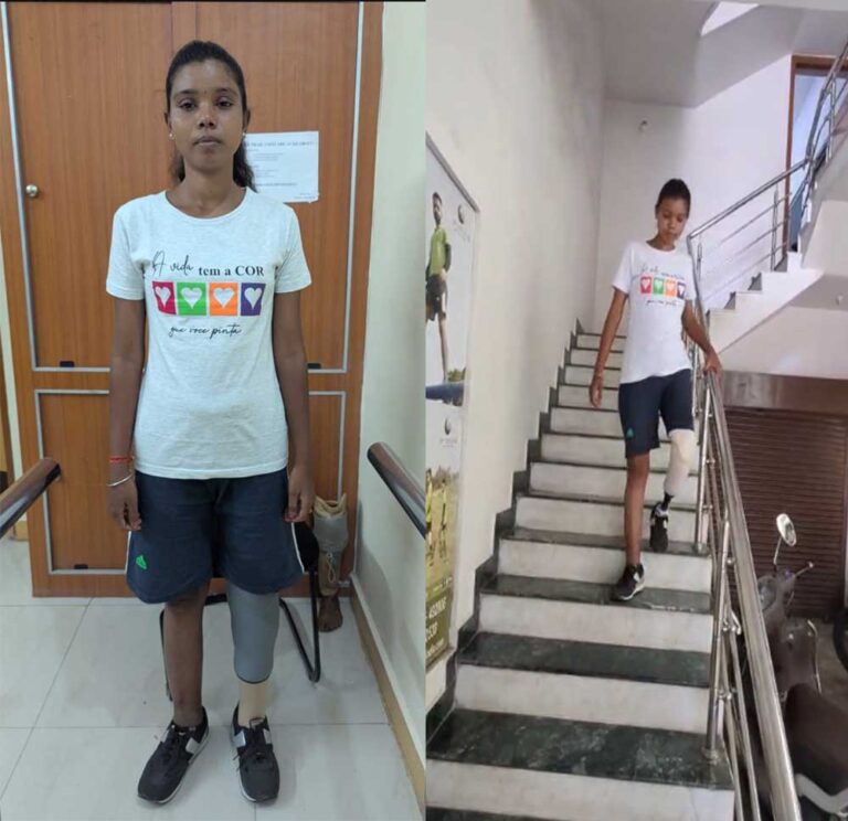 अब आत्मविश्वास के साथ सामान्य जीवन जी रहीं बबीता यादव, शासन-प्रशासन के प्रति जताया आभार