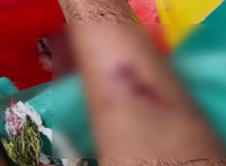 CG : बंदरों ने दर्जनभर लोगों पर किया हमला, दहशत का माहौल …