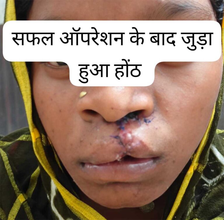 स्वास्थ्य सेवाओं की सफलता, सफल ऑपरेशन के बाद भीमे हेमला फिर मुस्कुराए