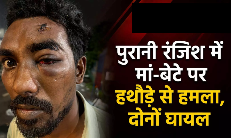 CG : पुरानी रंजिश में मां-बेटे पर हथौड़े से हमला, दोनों घायल …
