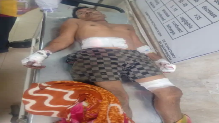 राजनांदगांव : खेत में काम कर रहे लोगों पर जंगली सुअरों का हमला…