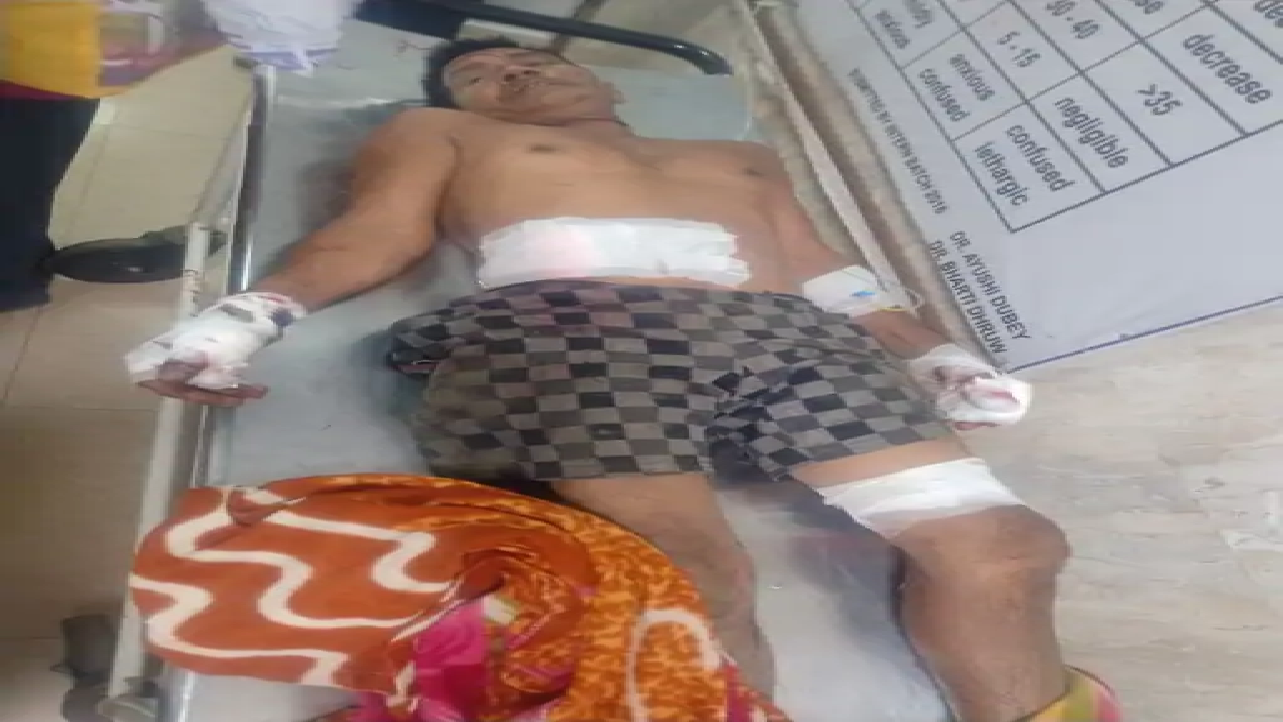 राजनांदगांव : खेत में काम कर रहे लोगों पर जंगली सुअरों का हमला…