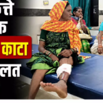 CG : आवारा कुत्ते का आतंक 13 लोगों को काटा तीन की हालत गंभीर …