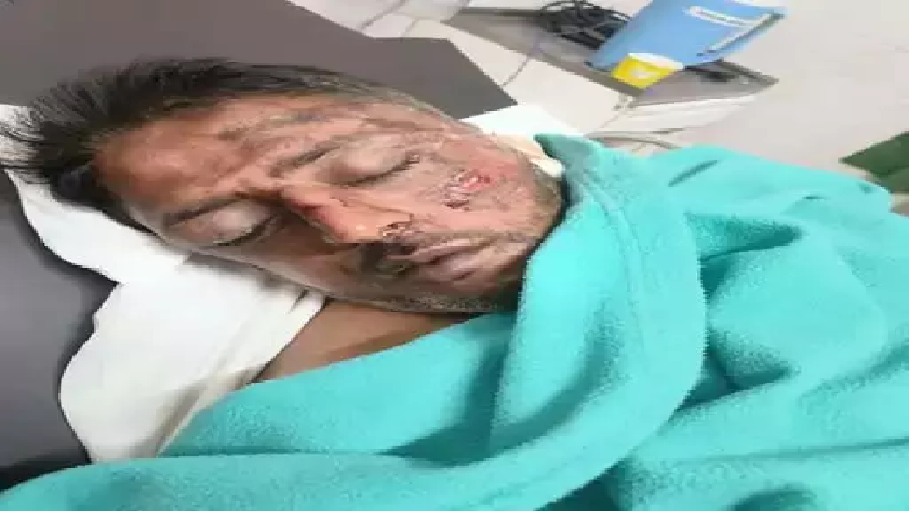 CG : कोरेक्स नाइट्रा बेचने वाले बदमाश का आतंक, बाइक से छोड़ने से मना करने पर मारपीट …