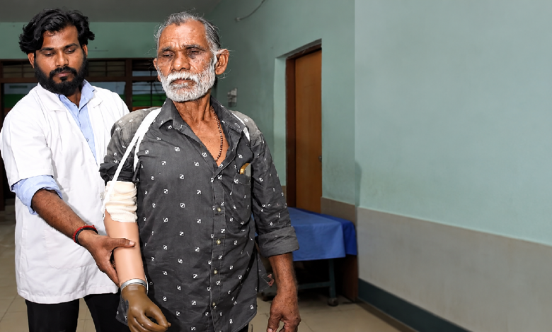 CG : ट्रेन हादसे के पीड़ित को ‘सेवा संकल्प’ से राहत, महज दो घंटे में मिला कृत्रिम हाथ…