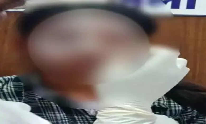 CG : लव प्रपोजल ठुकराने पर पुलिसकर्मी की बेटी पर एसिड अटैक, मुख्य आरोपी पुलिसकर्मी का बेटा अरेस्ट …