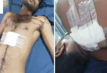 CG : रायपुर में चाकूबाजों का हमला, युवक को 7 बार मारा चाकू; एक की हालत नाजुक …