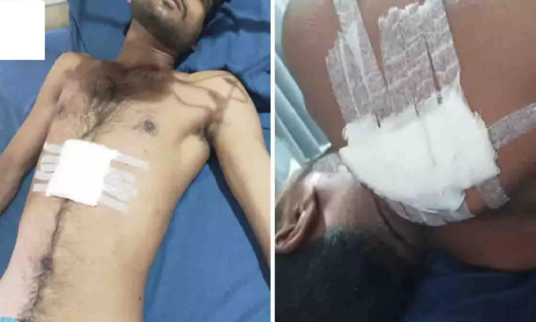 CG : रायपुर में चाकूबाजों का हमला, युवक को 7 बार मारा चाकू; एक की हालत नाजुक …